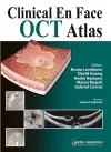 Clinical En Face OCT Atlas cover