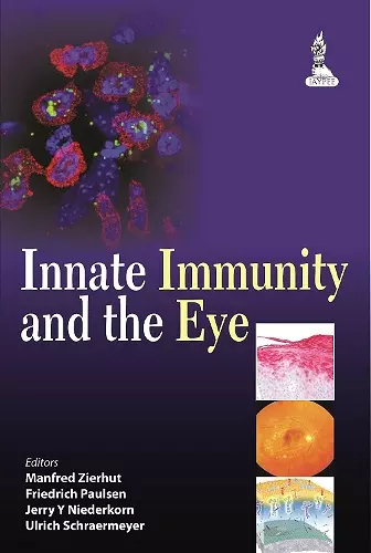 Innate Immunity and the Eye cover