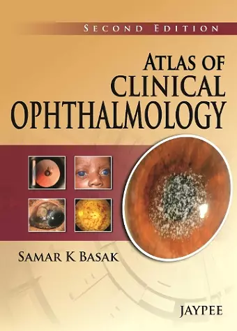 Atlas of Clinical Ophthalmology cover