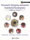 Descemet's Stripping Automated Endothelial Keratoplasty: Different Strokes cover