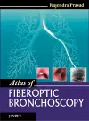 Atlas of Fiberoptic Bronchoscopy cover