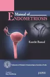 Manual of Endometriosis cover