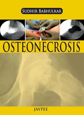 Osteonecrosis cover