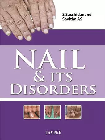 Nail & Its Disorders cover