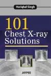 101 Chest X-Ray Solutions cover