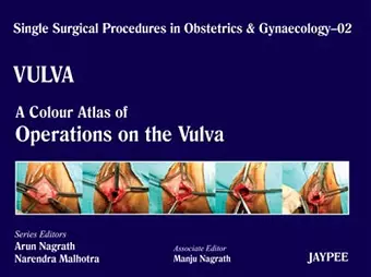 Single Surgical Procedures in Obstetrics and Gynaecology - Volume 2 - VULVA - A Colour Atlas of Operations on the Vulva cover