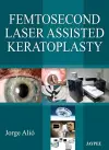 Femtosecond Laser Assisted Keratoplasty cover