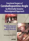 Functional Surgery of Cerebellopontine Angle by Minimally Invasive Retrosigmoid Approach cover