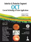 Anterior & Posterior Segment OCT: Current Technology & Future Applications cover