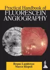 Practical Handbook of Fluorescein Angiography cover