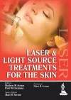 Laser and Light Source Treatments for the Skin cover