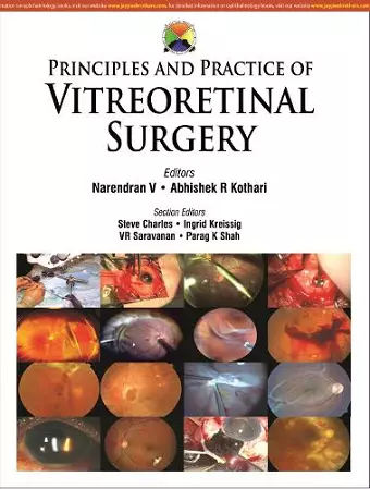 Principles and Practice of Vitreoretinal Surgery cover