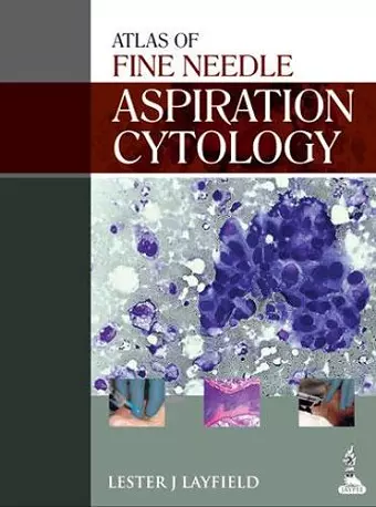 Atlas of Fine Needle Aspiration Cytology cover