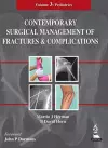 Contemporary Surgical Management of  Fractures and Complications cover