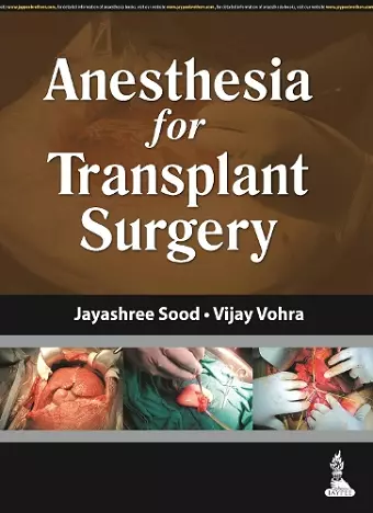 Anesthesia for Transplant Surgery cover