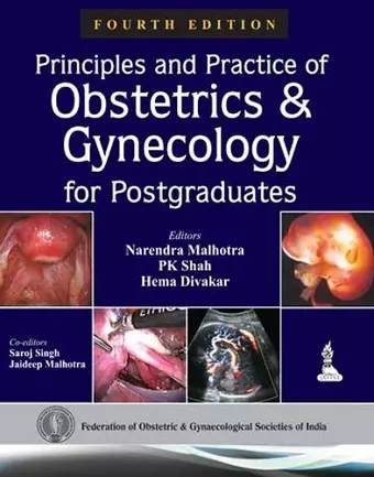 Principles and Practice of Obstetrics & Gynecology for Postgraduates cover