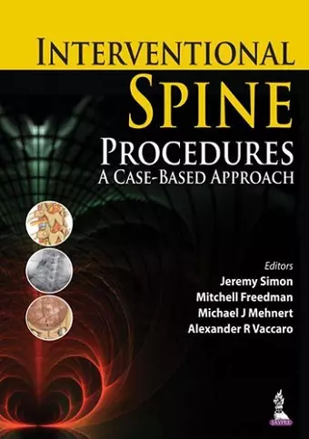 Interventional Spine Procedures cover