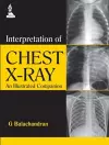 Interpretation of Chest X-Ray cover