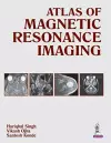 Atlas of Magnetic Resonance Imaging cover