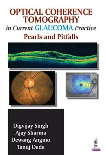 Optical Coherence Tomography in Current Glaucoma Practice cover