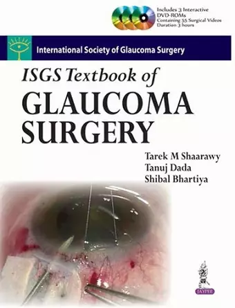 ISGS Textbook of Glaucoma Surgery cover