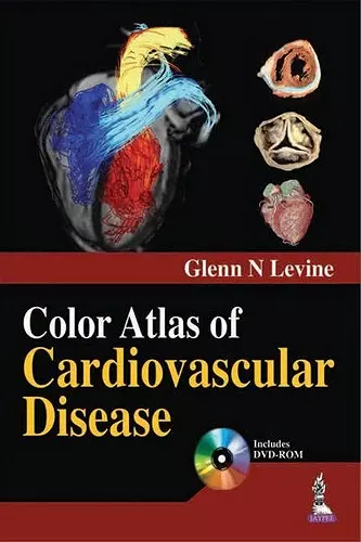 Color Atlas of Cardiovascular Disease cover