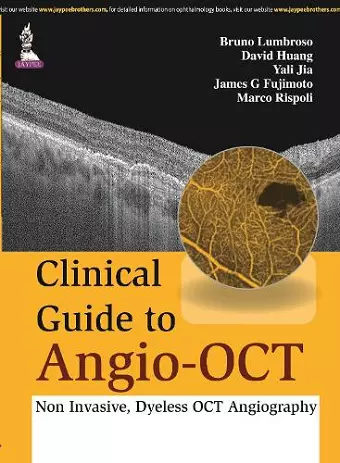 Clinical Guide to Angio-OCT: Non Invasive, Dyeless OCT Angiography cover