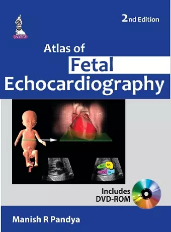 Atlas of Fetal Echocardiography cover