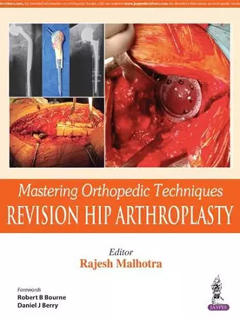 Mastering Orthopedic Techniques: Revision Total Hip Arthroplasty cover