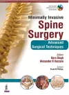 Minimally Invasive Spine Surgery cover