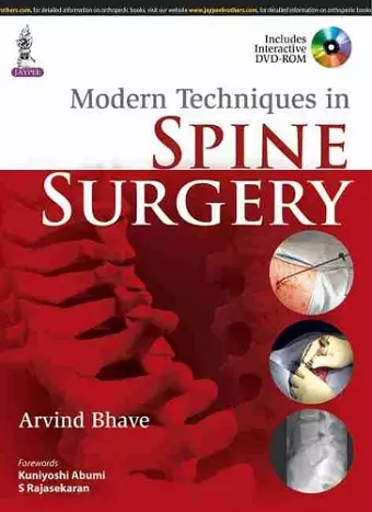 Modern Techniques in Spine Surgery cover