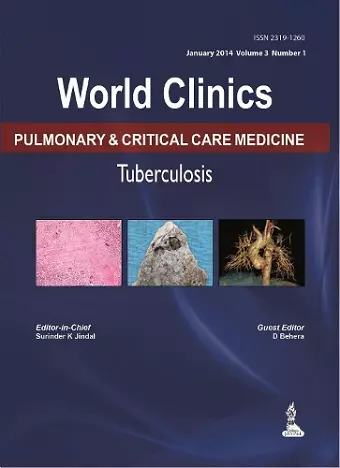 World Clinics: Pulmonary & Critical Care Medicine - Tuberculosis, Volume 3, No: 1 cover