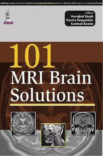 101 MRI Brain Solutions cover