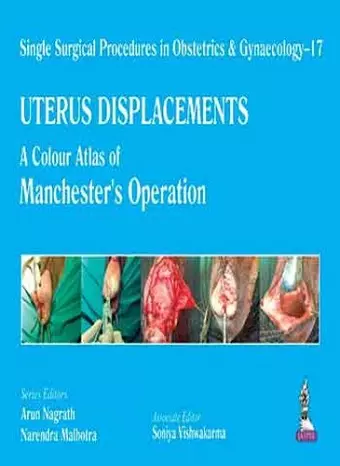 Single Surgical Procedures in Obstetrics and Gynaecology – 17 - UTERUS DISPLACEMENTS cover