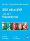 Single Surgical Procedures in Obstetrics and Gynaecology – 17 - UTERUS DISPLACEMENTS cover