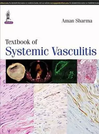 Textbook of Systemic Vasculitis cover