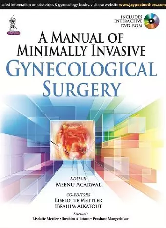 A Manual of Minimally Invasive Gynecological Surgery cover