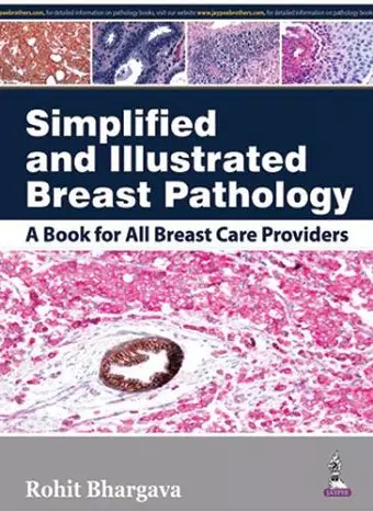 Simplified and Illustrated Breast Pathology cover