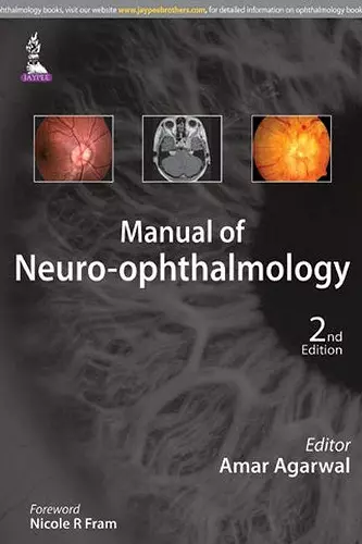 Manual of Neuro-ophthalmology cover