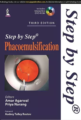 Step by Step Phacoemulsification cover