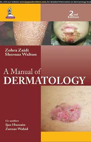 A Manual of Dermatology cover