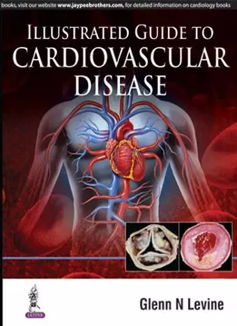 Illustrated Guide to Cardiovascular Disease cover