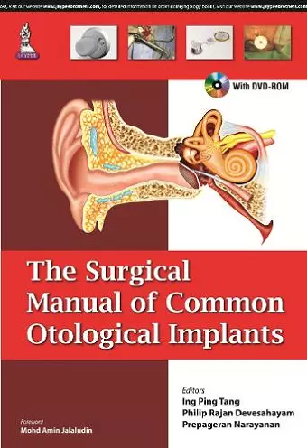 The Surgical Manual of Common Otological Implants cover