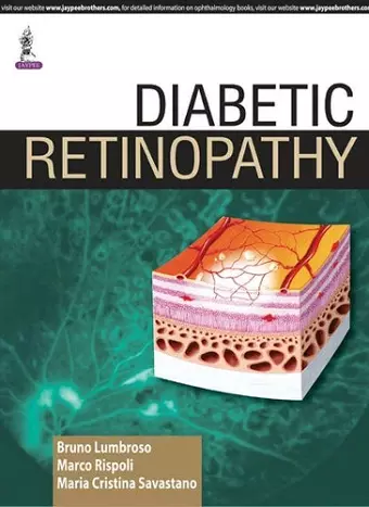 Diabetic Retinopathy cover