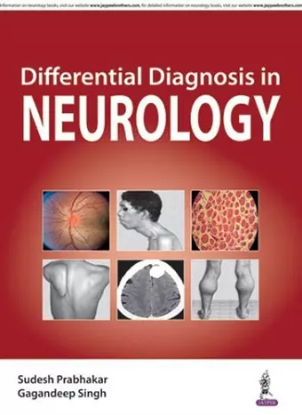 Differential Diagnosis in Neurology cover