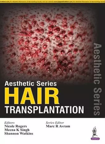 Aesthetic Series - Hair Transplantation cover