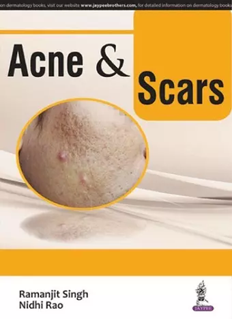 Acne & Scars cover