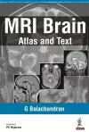 MRI Brain cover