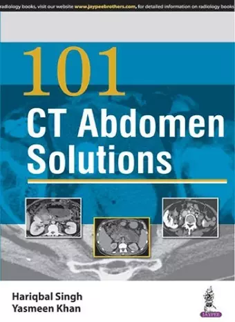 101 CT Abdomen Solutions cover