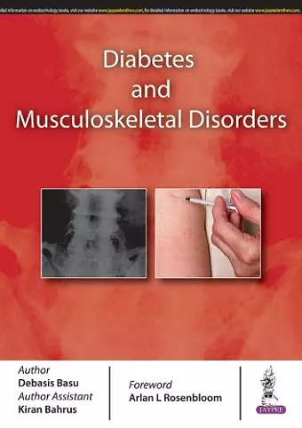 Diabetes and Musculoskeletal Disorders cover